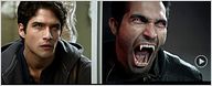 Regardez les 10 premières minutes de la saison 2 de "Teen Wolf" [VIDEO]