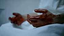 image de The Knick - saison 1 Teaser (2) VO