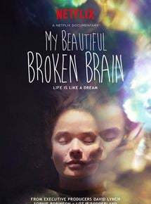 My Beautiful Broken Brain