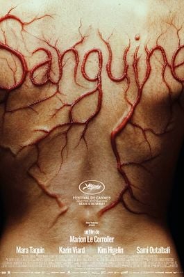 Sanguine