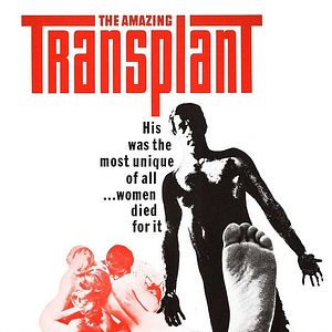 Photo The Amazing Transplant