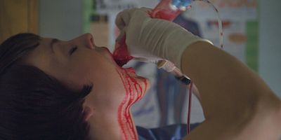 poster de la série Les vaisseaux sanguins