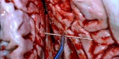 poster de la série Détour vers le futur