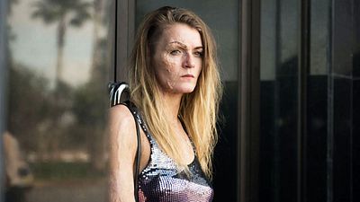 image de la news Attaques à l'acide : comment le film Dirty God a choisi une actrice réellement brûlée