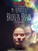 poster de My Beautiful Broken Brain
