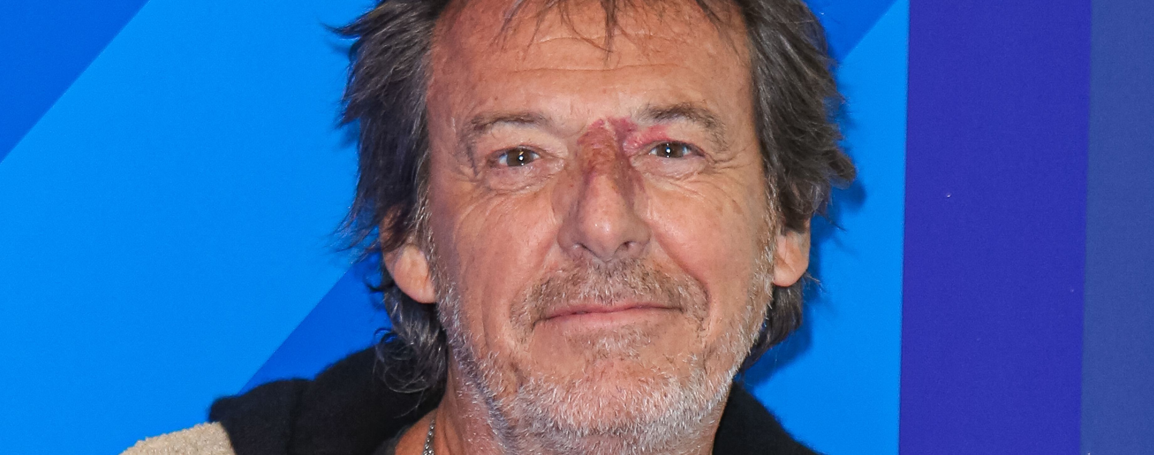 "Je suis mort demain, faites attention" JeanLuc Reichmann (Les Douze